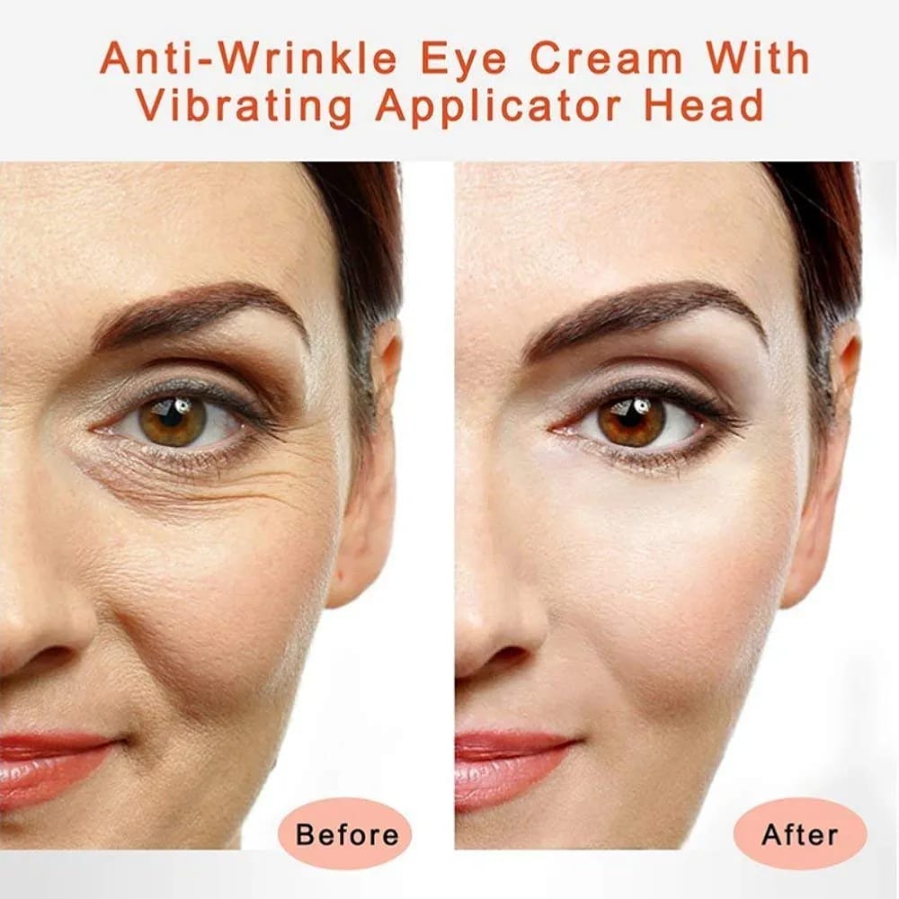 Eye Cream with High Frequency Electric Vibration